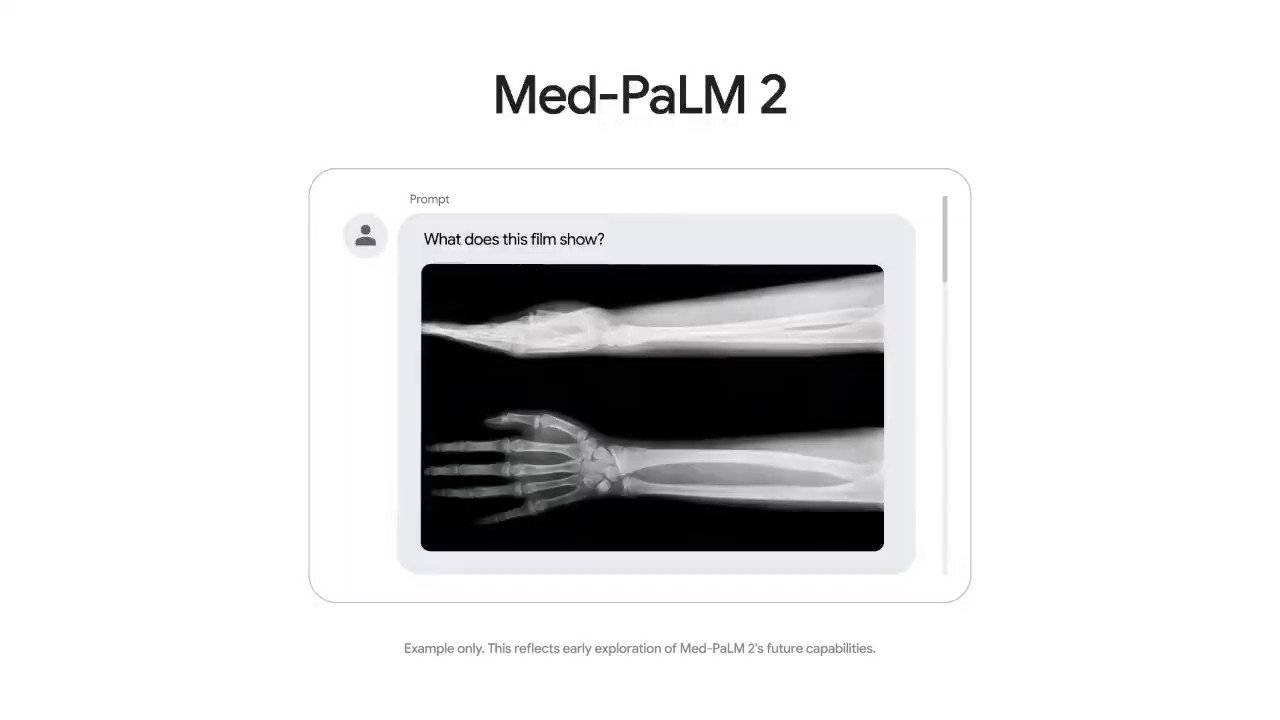 Google, medikal yapay zekası Med-PaLM 2'yi test etmeye başladı