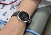 Galaxy Watch bayılma tahmini için klinik çalışmada doğrulandı
