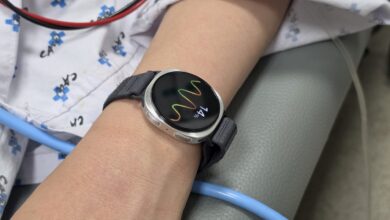 Galaxy Watch bayılma tahmini için klinik çalışmada doğrulandı