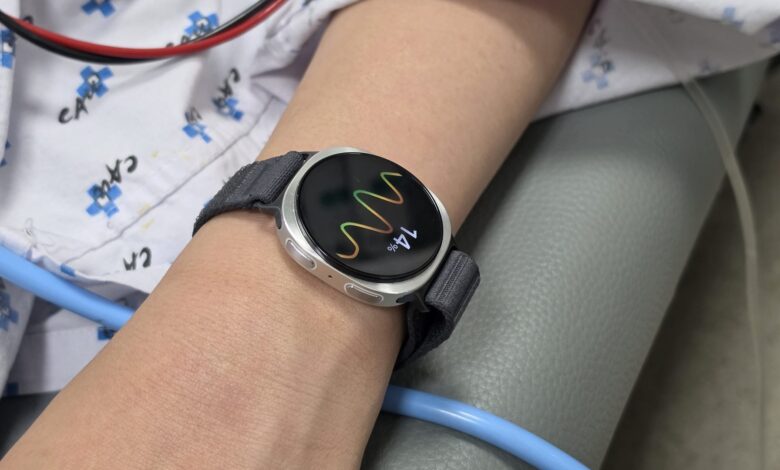 Galaxy Watch bayılma tahmini için klinik çalışmada doğrulandı